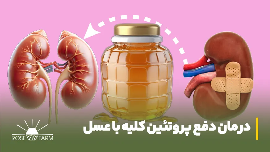 عسل برای درمان دفع پروتئین کلیه