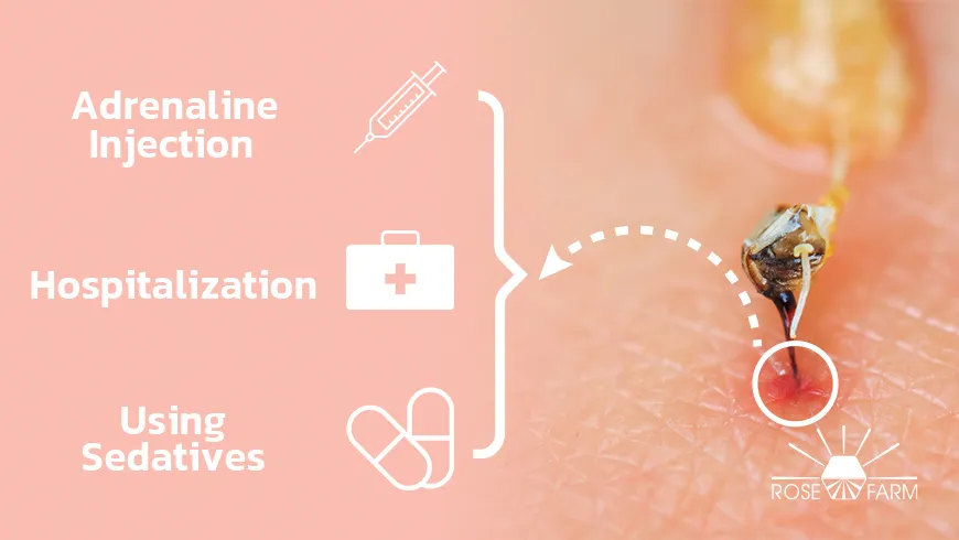 درمان نیش زنبورهای قاتل
